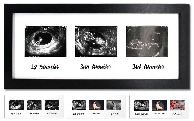 IHEIPYE Triple Sonogram Pregnancy Frame â€“ Baby Ultrasound Picture Frame with Story for Expecting Parents, Baby Shower Frame, Baby Grow Through All Three Trimesters Frame, Nursery Decor, Black - Image 1